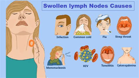 19 oct 2016. . Can fasting cause swollen lymph nodes
